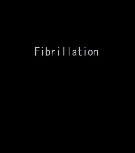 Portada de Fibrillation