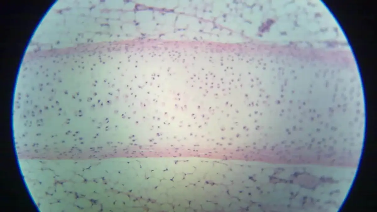 Portada de LeukoBlast!