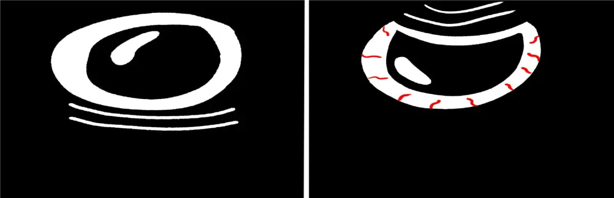 Playback Trauma: In Sickness