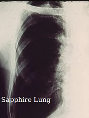 Portada de Sapphire Lung