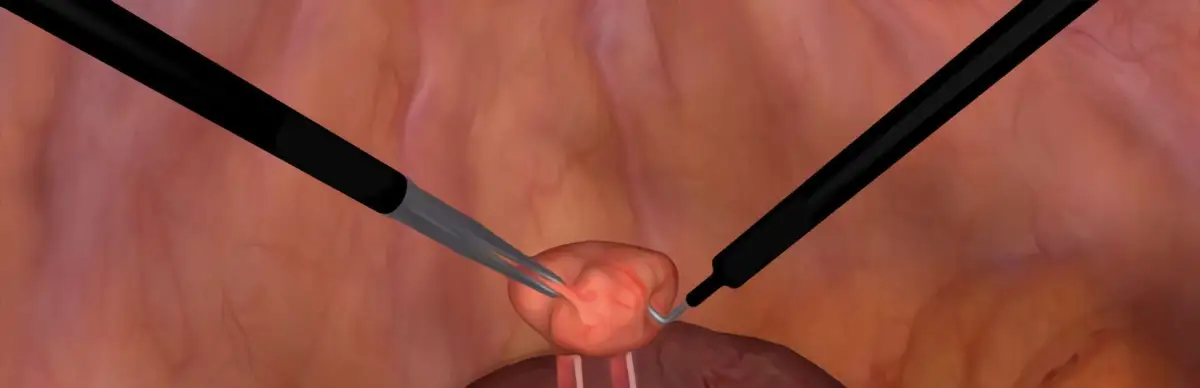 Surgical Robot Simulator